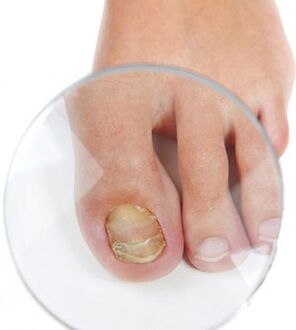 Nail trunk