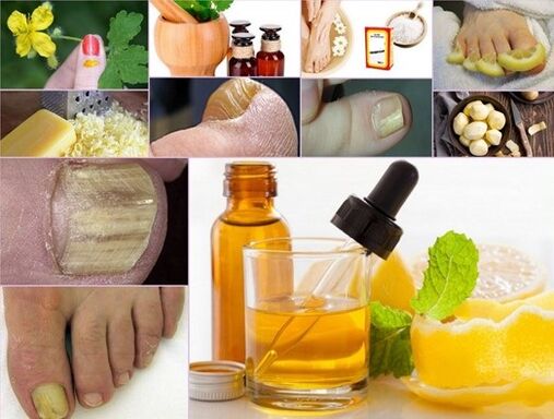 Folk remedies for the treatment of nail fungus